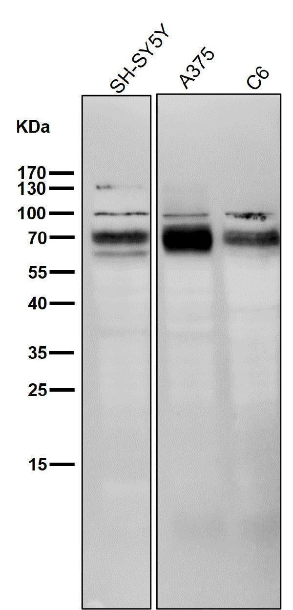Anti-BACE1/Bace Rabbit Monoclonal Antibody Boster Bio