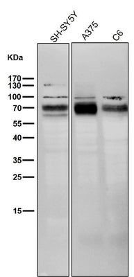 Anti-BACE1/Bace Rabbit Monoclonal Antibody Boster Bio
