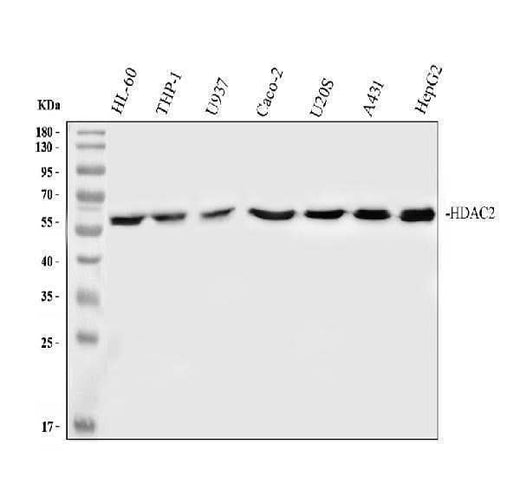 Anti-HDAC2/Histone Deacetylase 2 Rabbit Monoclonal Antibody Boster Bio