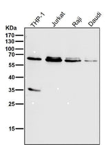 Anti-HDAC2/Histone Deacetylase 2 Rabbit Monoclonal Antibody Boster Bio