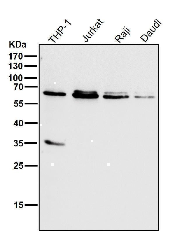 Anti-HDAC2/Histone Deacetylase 2 Rabbit Monoclonal Antibody Boster Bio