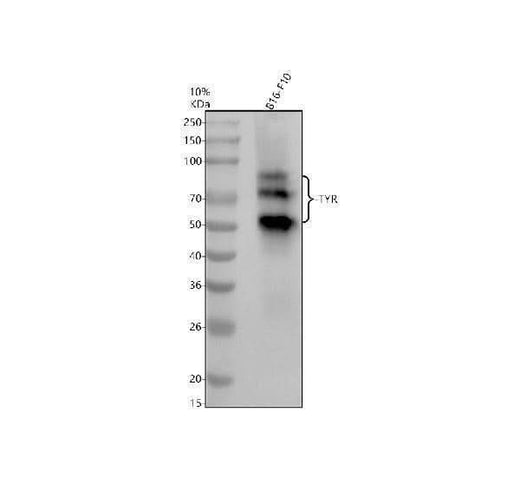 Anti-Tyrosinase Rabbit Monoclonal Antibody Boster Bio