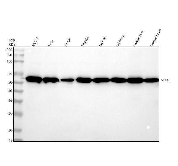 Anti-CYBB/Nox2 Rabbit Monoclonal Antibody Boster Bio