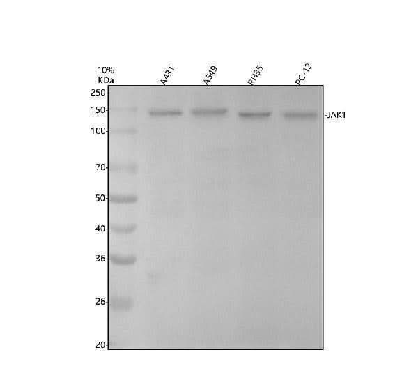 Anti-JAK1 Rabbit Monoclonal Antibody Boster Bio