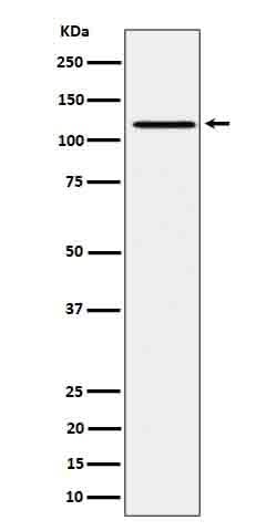 Anti-Phospho-JAK1 (Y1034 + Y1035) Rabbit Monoclonal Antibody Boster Bio