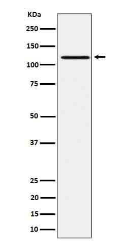Anti-Phospho-JAK1 (Y1034 + Y1035) Rabbit Monoclonal Antibody Boster Bio