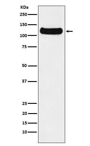 Anti-DDB1 Monoclonal Antibody Boster Bio