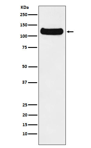 Anti-DDB1 Monoclonal Antibody Boster Bio