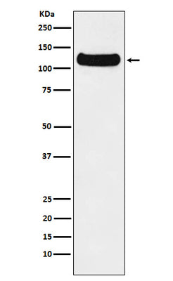 Anti-DDB1 Monoclonal Antibody Boster Bio