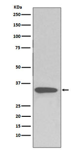 Anti-pro Caspase 3 CASP3 Rabbit Monoclonal Antibody Boster Bio
