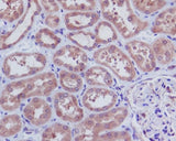 Anti-Caspase-3 p12 CASP3 Rabbit Monoclonal Antibody Boster Bio