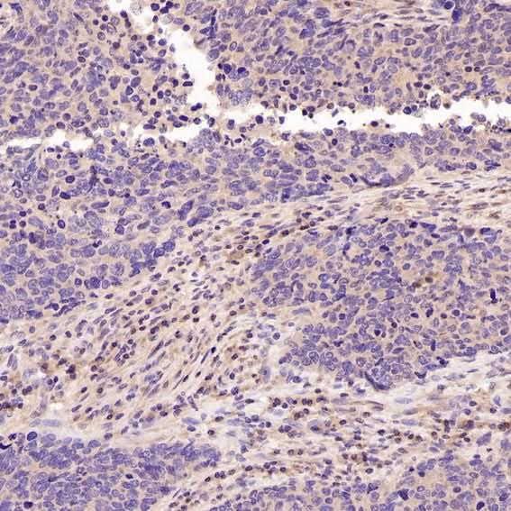 Anti-active + pro Caspase 3 CASP3 Rabbit Monoclonal Antibody Boster Bio