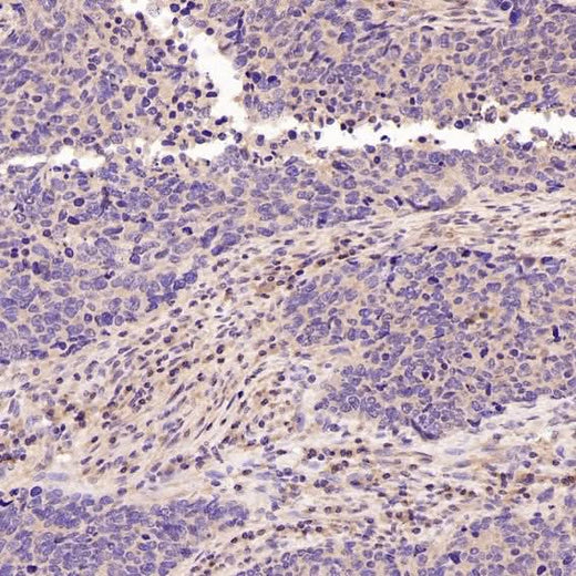 Anti-active + pro Caspase 3 CASP3 Rabbit Monoclonal Antibody Boster Bio
