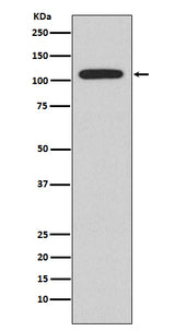 Anti-NFAT2 NFATC1 Rabbit Monoclonal Antibody Boster Bio