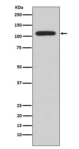Anti-NFAT2 NFATC1 Rabbit Monoclonal Antibody Boster Bio
