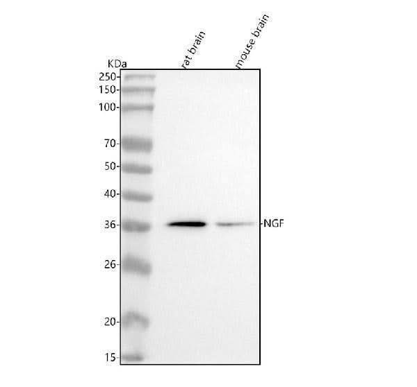 Anti-NGF/Beta Ngf Rabbit Monoclonal Antibody Boster Bio