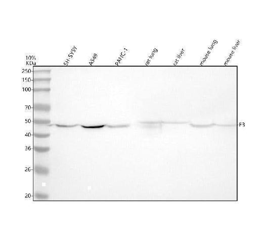 Anti-Tissue Factor Rabbit Monoclonal Antibody Boster Bio