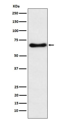 Anti-CYP24A1 Rabbit Monoclonal Antibody Boster Bio