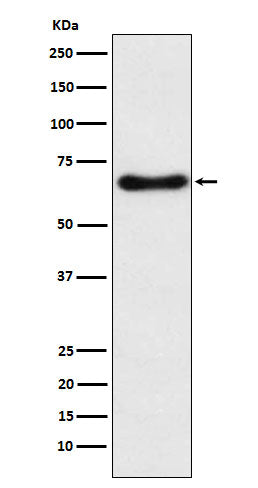 Anti-CYP24A1 Rabbit Monoclonal Antibody Boster Bio