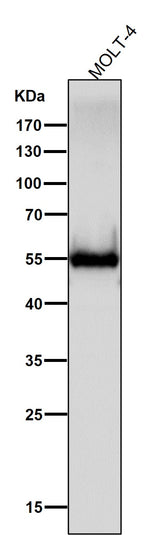 Anti-CD4 Rabbit Monoclonal Antibody Boster Bio