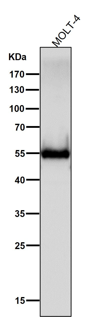Anti-CD4 Rabbit Monoclonal Antibody Boster Bio