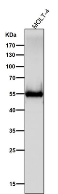Anti-CD4 Rabbit Monoclonal Antibody Boster Bio