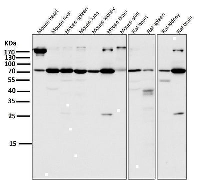 Anti-Atg7 (Apg7) Monoclonal Antibody Boster Bio