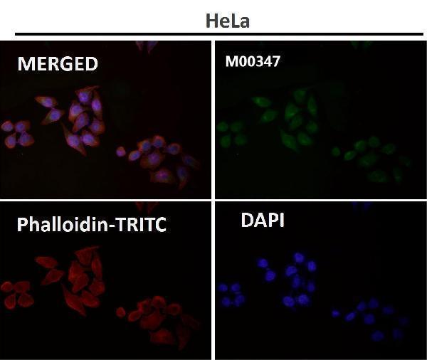 Anti-Rad50 Monoclonal Antibody Boster Bio