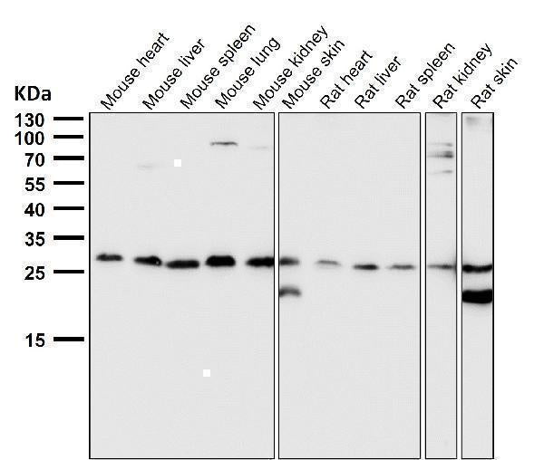 Anti-PDGF B Rabbit Monoclonal Antibody Boster Bio