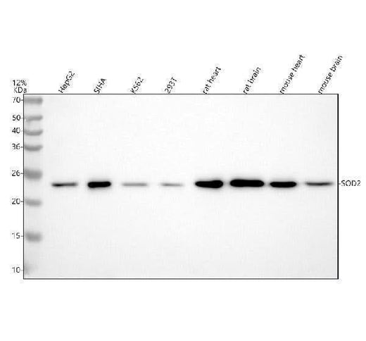 Anti-SOD2 (acetyl K68) Rabbit Monoclonal Antibody Boster Bio