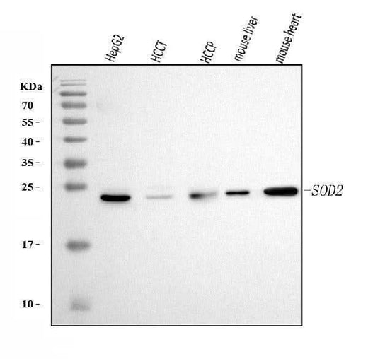 Anti-SOD2 Antibody Picoband® (monoclonal, 2B12B1 Boster Bio