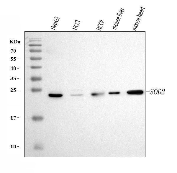 Anti-SOD2 Antibody Picoband® (monoclonal, 2B12B1 Boster Bio