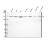 Anti-Leptin Receptor LEPR Rabbit Monoclonal Antibody Boster Bio