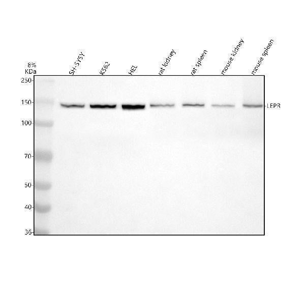 Anti-Leptin Receptor LEPR Rabbit Monoclonal Antibody Boster Bio