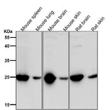 Anti-GRB2 Rabbit Monoclonal Antibody Boster Bio