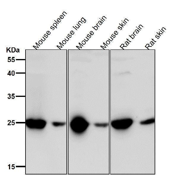 Anti-GRB2 Rabbit Monoclonal Antibody Boster Bio
