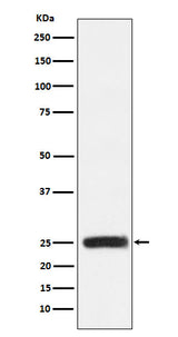 Anti-GRB2 Monoclonal Antibody Boster Bio