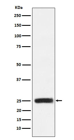 Anti-GRB2 Monoclonal Antibody Boster Bio