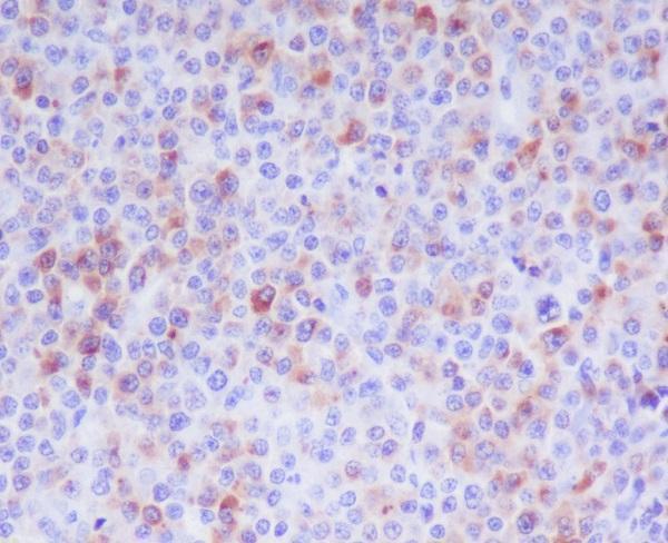 Anti-Granzyme B GZMB Monoclonal Antibody Boster Bio