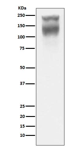Anti-CEA (CD66e) CEACAM5 Rabbit Monoclonal Antibody Boster Bio