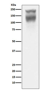 Anti-CEA (CD66e) CEACAM5 Rabbit Monoclonal Antibody Boster Bio