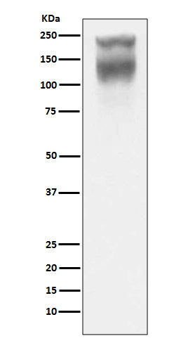 Anti-CEA (CD66e) CEACAM5 Rabbit Monoclonal Antibody Boster Bio