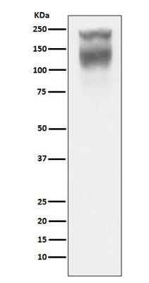 Anti-CEA (CD66e) CEACAM5 Rabbit Monoclonal Antibody Boster Bio