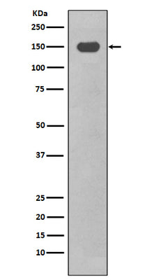 Anti-CD11c ITGAX Rabbit Monoclonal Antibody Boster Bio