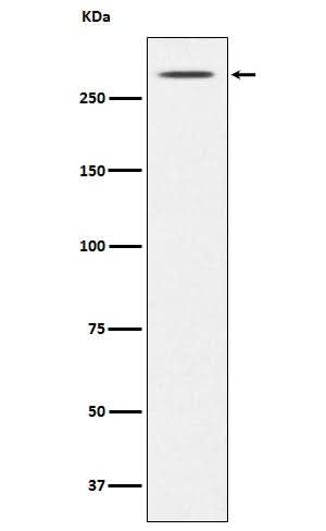 Anti-Thyroglobulin TG Monoclonal Antibody Boster Bio