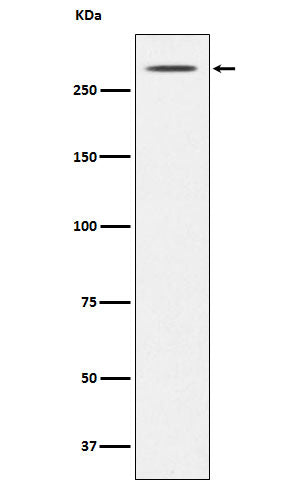 Anti-Thyroglobulin TG Monoclonal Antibody Boster Bio