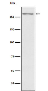 Anti-Thyroglobulin TG Monoclonal Antibody Boster Bio