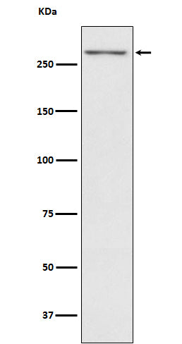 Anti-Thyroglobulin TG Monoclonal Antibody Boster Bio