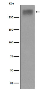 Anti-Thyroglobulin Rabbit Monoclonal Antibody Boster Bio