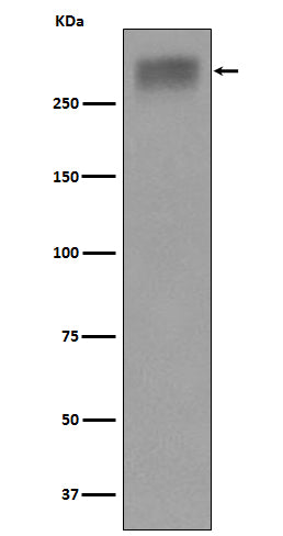 Anti-Thyroglobulin Rabbit Monoclonal Antibody Boster Bio